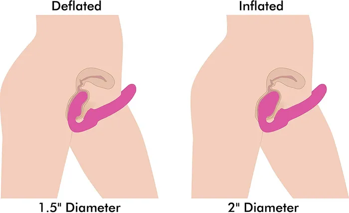 Anal Castle Megastore Strap U 10X Evoke ErgoFit Purple