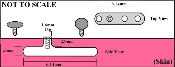 Painful Pleasures Vibrators 14g 12g Dermal Piercing Healing Post Price Per 1